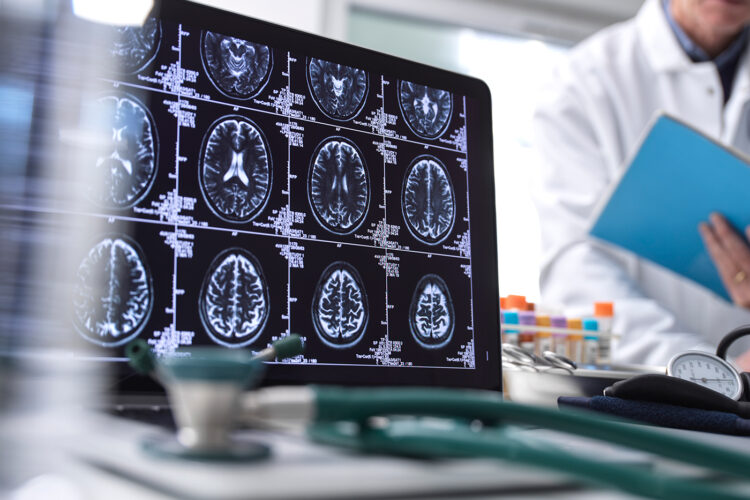 Unlocking answers for childhood brain tumors