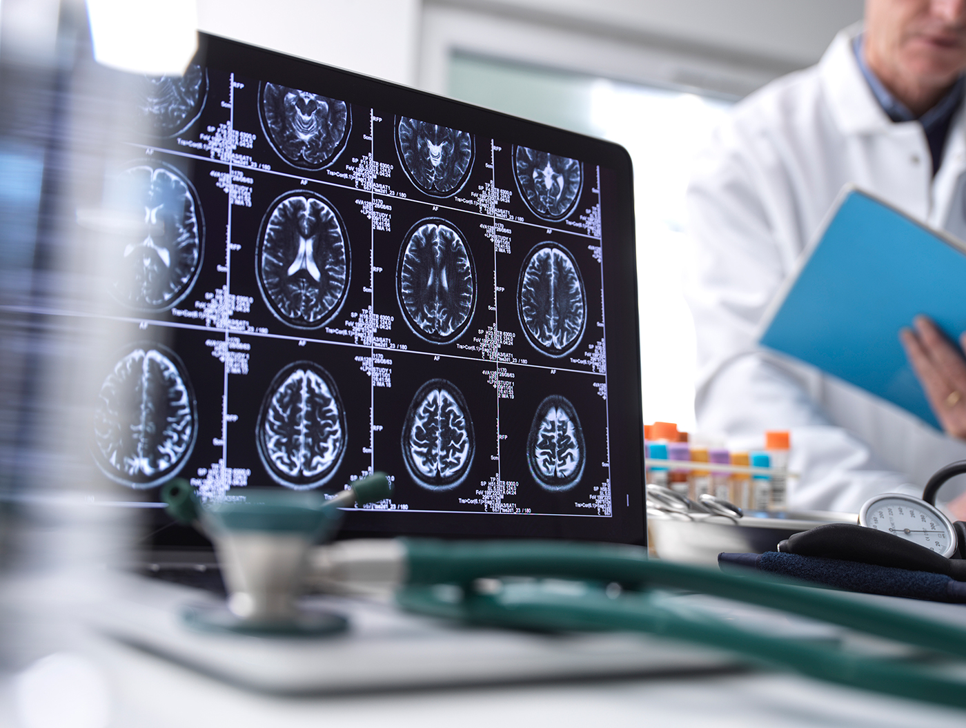 doctor review brain scans